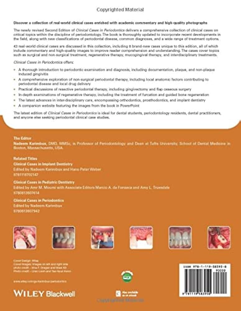 健康・医学 Textbook of Clinical Periodontology 71ljnioiYmL._UF350,350_QL50_.jpg